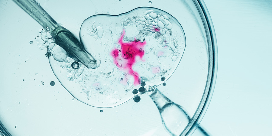 Fachveranstaltung: Personalisierte Stimulation in der Praxis
