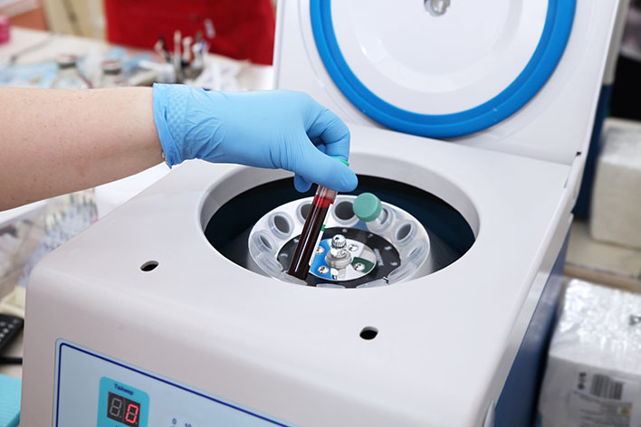 Neuer Behandlungsansatz bei wiederholtem IVF-Implantationsversagen und dünner Gebärmutterschleimhaut